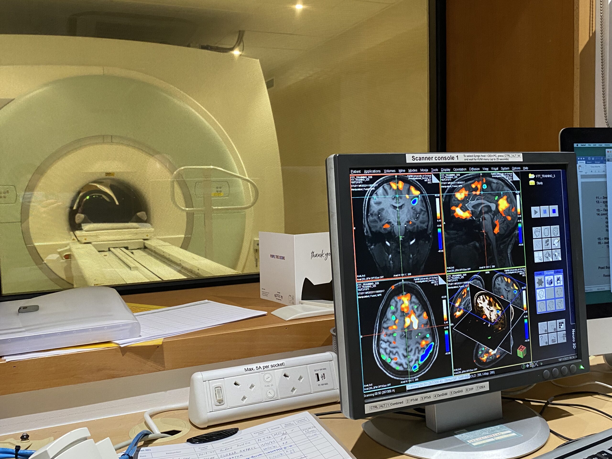 MRI Scanning